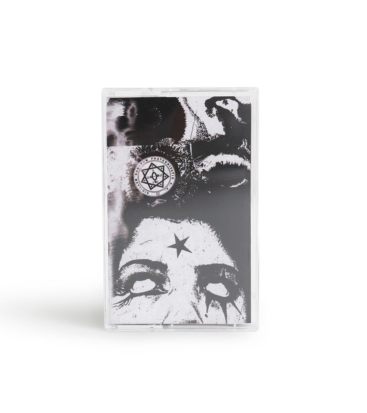FILTH AND DEGREGATION CASSETTE